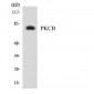 PRKCB / PKC-Beta Antibody (aa606-655)